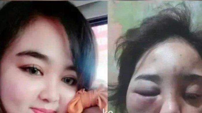 BONYOK Ibu Muda Disiksa Suami Wajahnya Berubah Drastis hingga Dikurung, Sang Kakak Ngamuk
