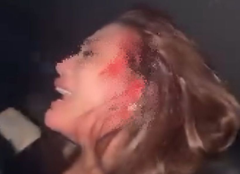 Viral! Perempuan Cantik Histeris Kepalanya Berdarah Diduga Dipukul Senpi